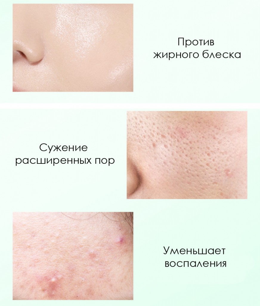 Ночная матирующая гелевая маска с салициловой кислотой и центеллой Bioaqua, 120 мл.